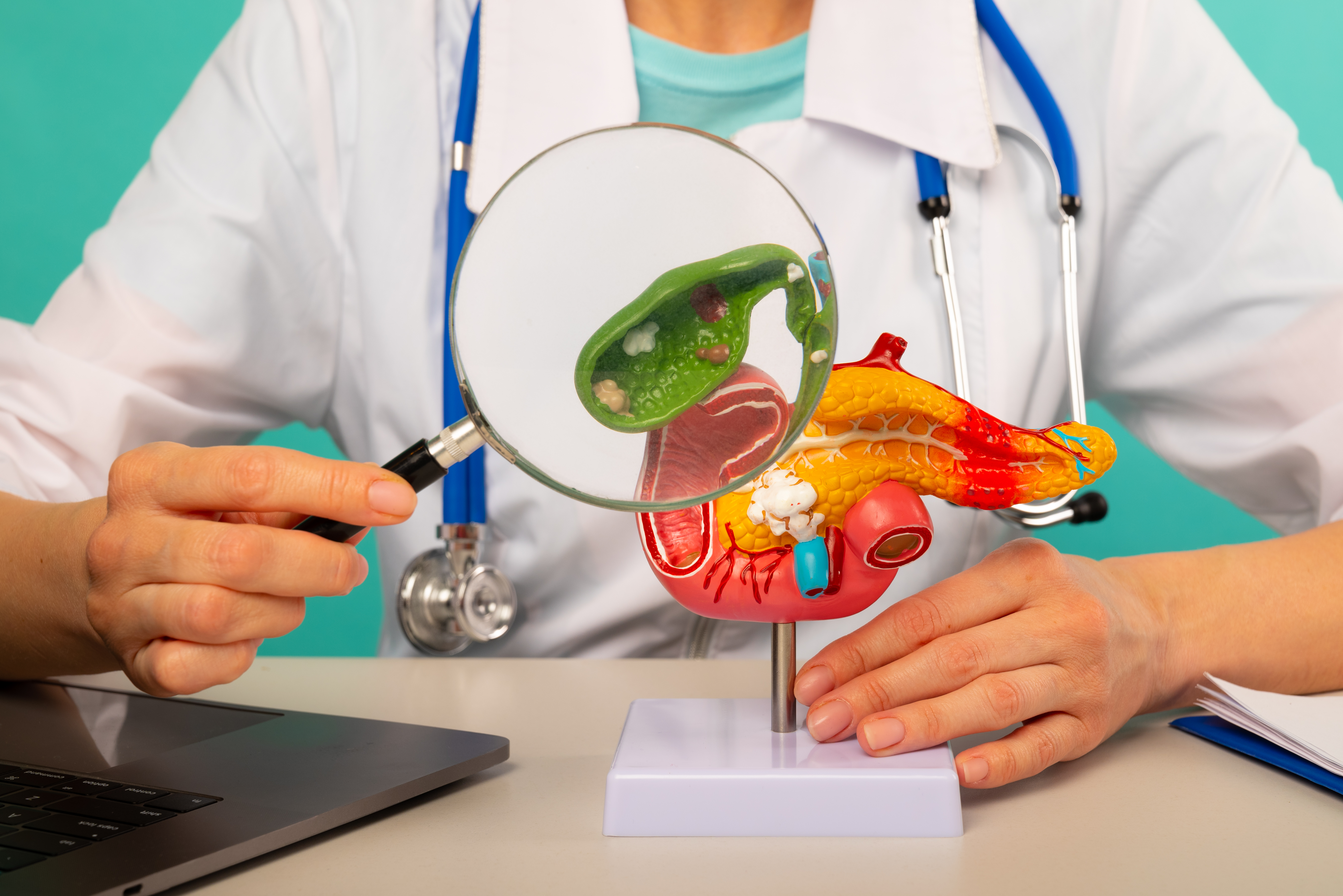 Gall & Kidney Stones